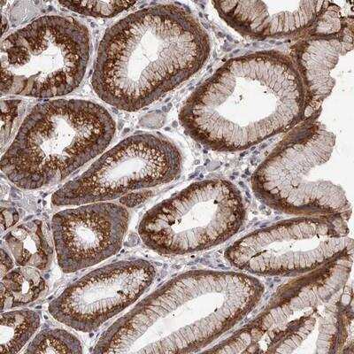 Immunohistochemistry-Paraffin: NAV1 Antibody [NBP1-84082]