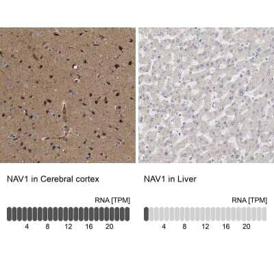 Immunohistochemistry-Paraffin: NAV1 Antibody [NBP1-84083]