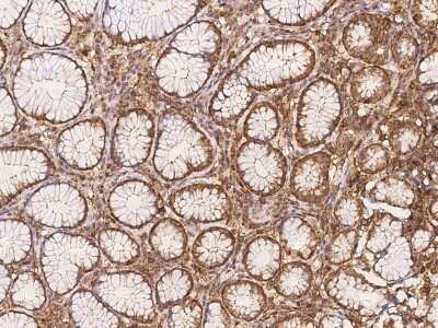 Immunohistochemistry-Paraffin: NAV1 Antibody [NBP3-06303]