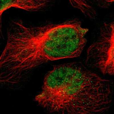 Immunocytochemistry/ Immunofluorescence: NAV2 Antibody [NBP1-84615]