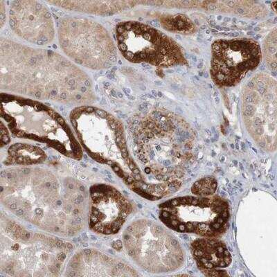 Immunohistochemistry-Paraffin: NAV2 Antibody [NBP1-84616]