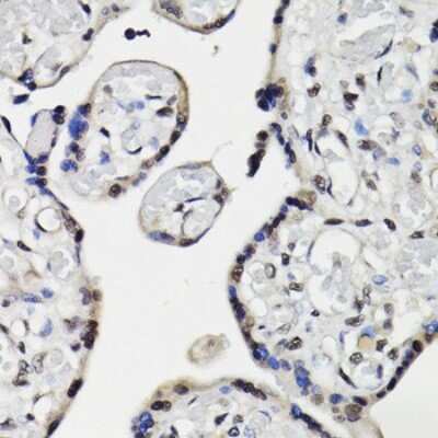 Immunohistochemistry-Paraffin: NAV2 Antibody - Azide and BSA Free [NBP3-04796]