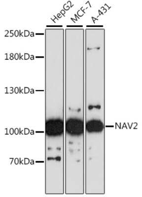 Western Blot: NAV2 AntibodyAzide and BSA Free [NBP3-04796]