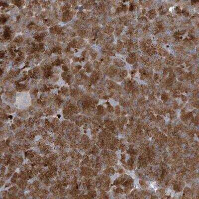 Immunohistochemistry-Paraffin: NAV3 Antibody [NBP1-82950]