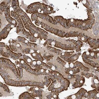 Immunohistochemistry-Paraffin: NAV3 Antibody [NBP1-82951]