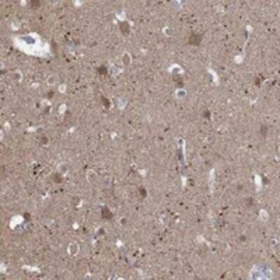 Immunohistochemistry-Paraffin: NAV3 Antibody [NBP3-17520]