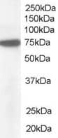 Western Blot: Nucleoporin NUP85 Antibody [NB100-1355]