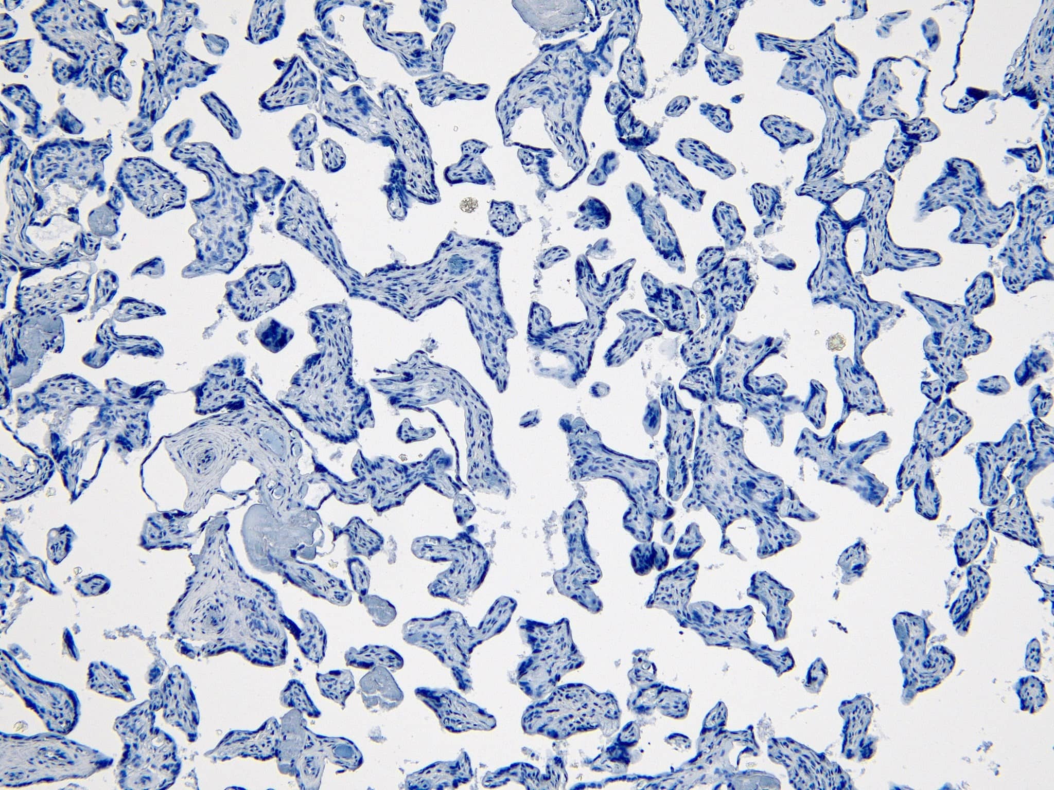 Immunohistochemistry-Paraffin: Indoleamine 2,3-dioxygenase/IDO Antibody [NB100-2459]
