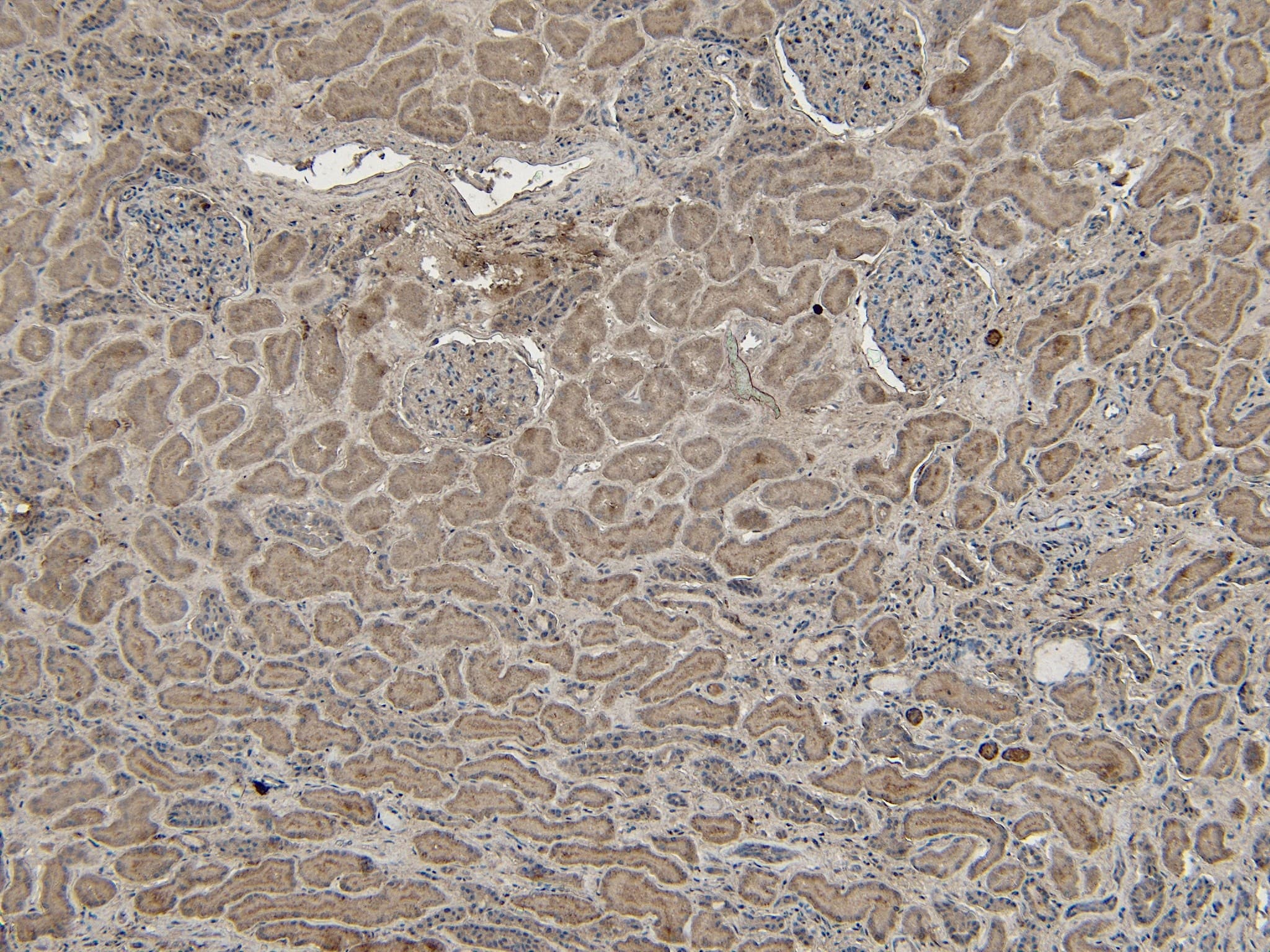 Immunohistochemistry-Paraffin: VPS25 Antibody [NB100-2468]