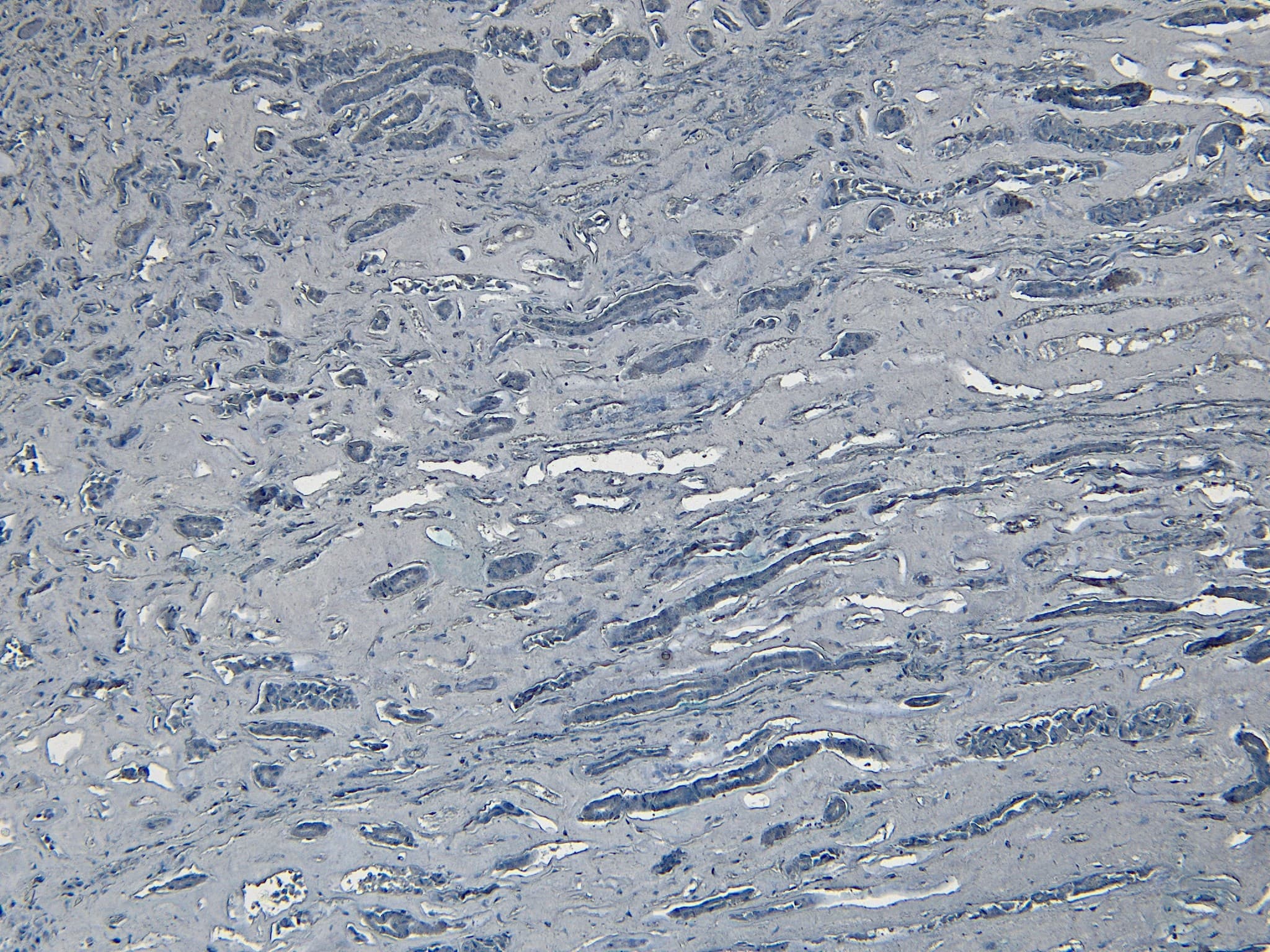 Immunohistochemistry-Paraffin: VPS25 Antibody [NB100-2468]