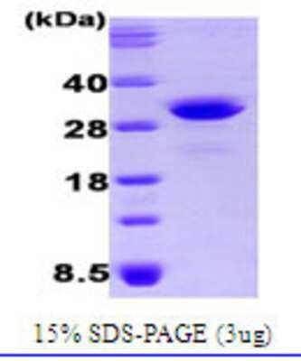 Western Blot: Recombinant Human OSTF1 His Protein [NBC1-19070]