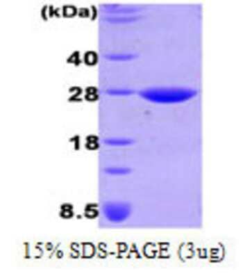 Western Blot: Recombinant E. coli DsbG Protein [NBC1-21274]