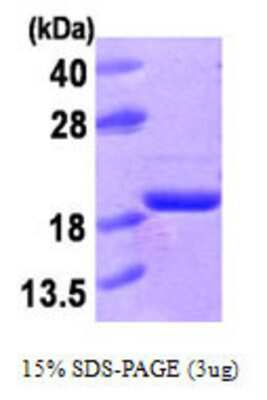 SDS-PAGE: Recombinant Human LMW-PTP/ACP1 His Protein [NBC1-21279]