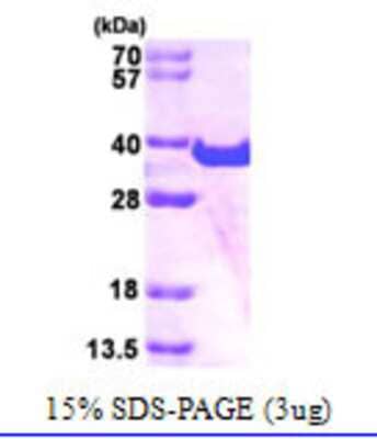 Western Blot: Recombinant Human SPG21 His Protein [NBC1-21650]