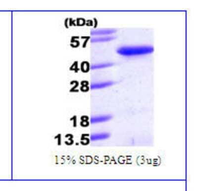 Western Blot: Recombinant Human PINX1 His Protein [NBC1-26375]