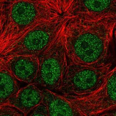 Immunocytochemistry/ Immunofluorescence: NBEAL1 Antibody [NBP2-33553]