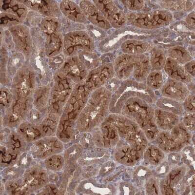 Immunohistochemistry: NBEAL1 Antibody [NBP2-33553]