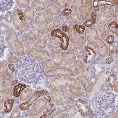 Immunohistochemistry-Paraffin: NBEAL1 Antibody [NBP2-33568]