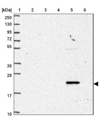 Western Blot: NBEAL1 Antibody [NBP2-33568]