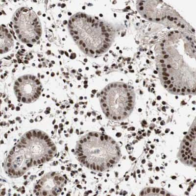 Immunohistochemistry-Paraffin: DAN/NBL1 Antibody [NBP1-85340]