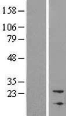 Western Blot: DAN/NBL1 Overexpression Lysate [NBL1-13496]