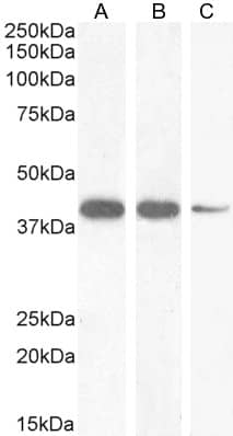 Western Blot: NKX2.5 Antibody [NBP1-51953]