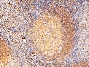 Immunohistochemistry-Paraffin: RAC2 Antibody [NBP2-31086]