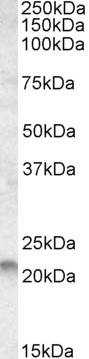 Western Blot: RAC2 Antibody [NBP2-31086]