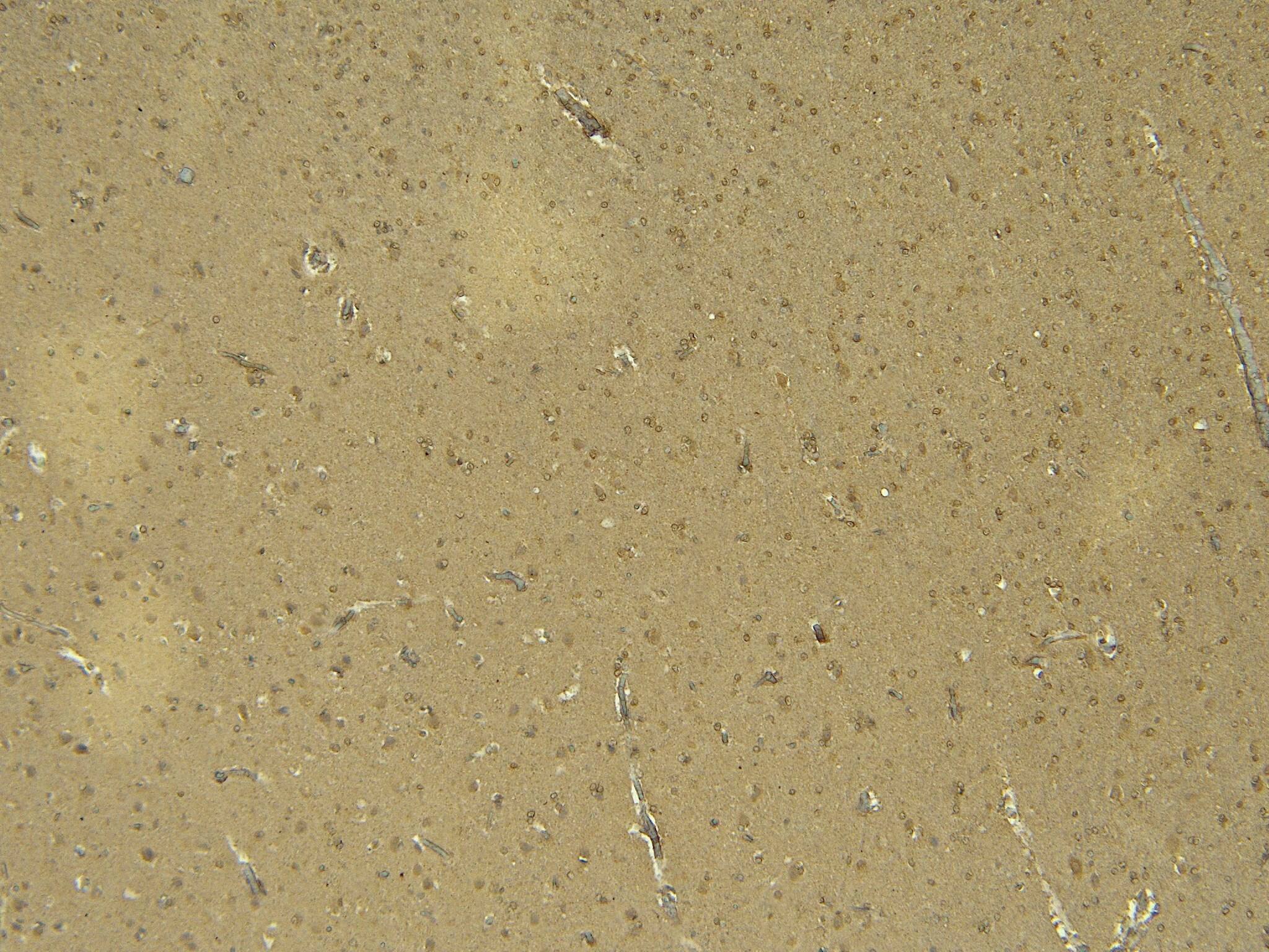 Immunohistochemistry-Paraffin: Doublecortin Antibody [NBP2-69992]
