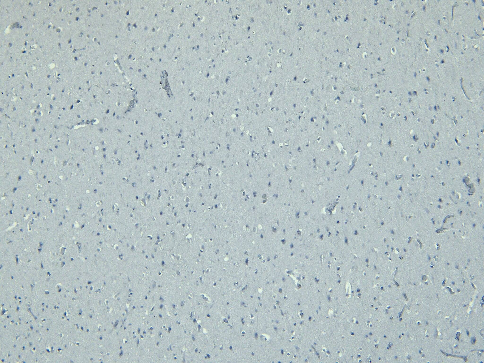 Immunohistochemistry-Paraffin: Doublecortin Antibody [NBP2-69992]