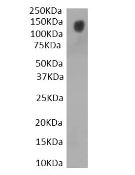 Western Blot: SARS-CoV-2 Spike S1 Antibody [NBP3-20226]