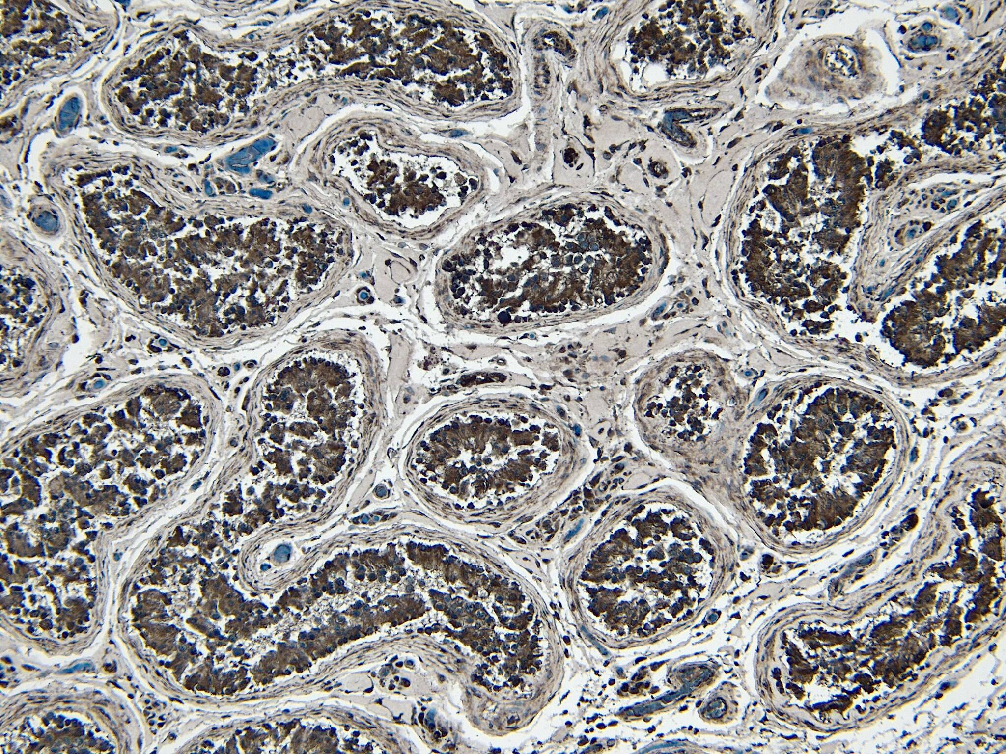Immunohistochemistry-Paraffin: STAM-1 Antibody [NBP3-20227]
