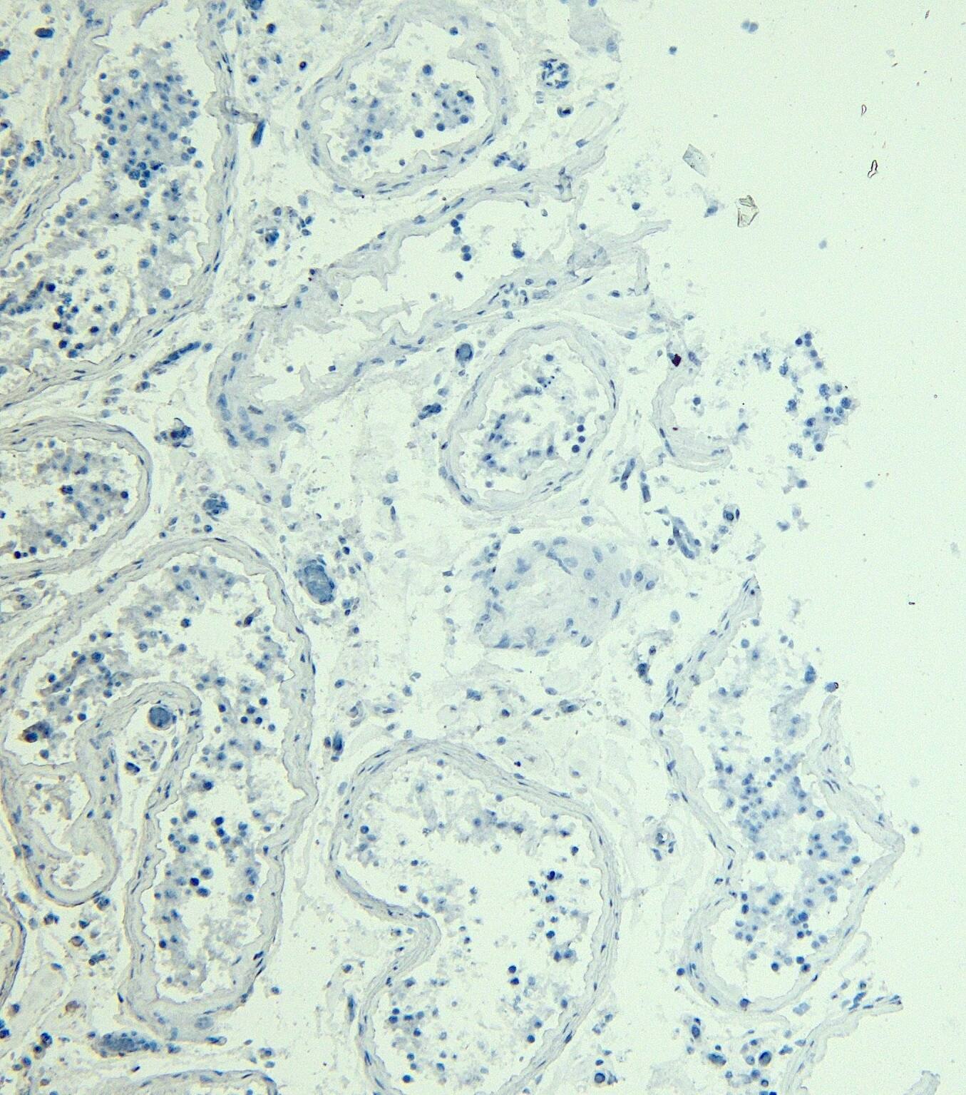 Immunohistochemistry-Paraffin: STAM-1 Antibody [NBP3-20227]