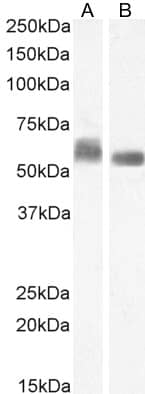 Western Blot: STAM-1 Antibody [NBP3-20227]