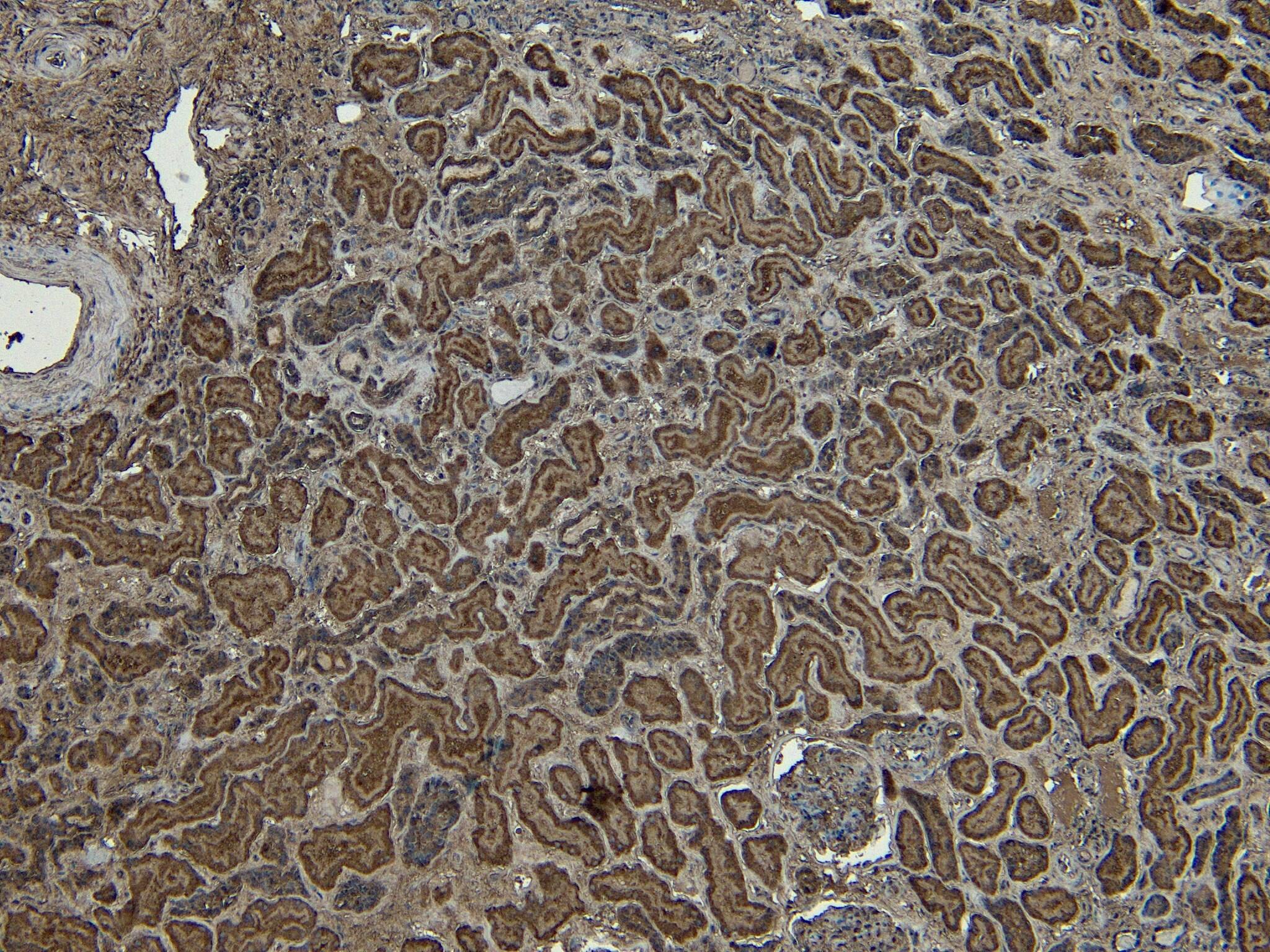 Immunohistochemistry-Paraffin: PLC-delta 3 Antibody [NBP3-20228]