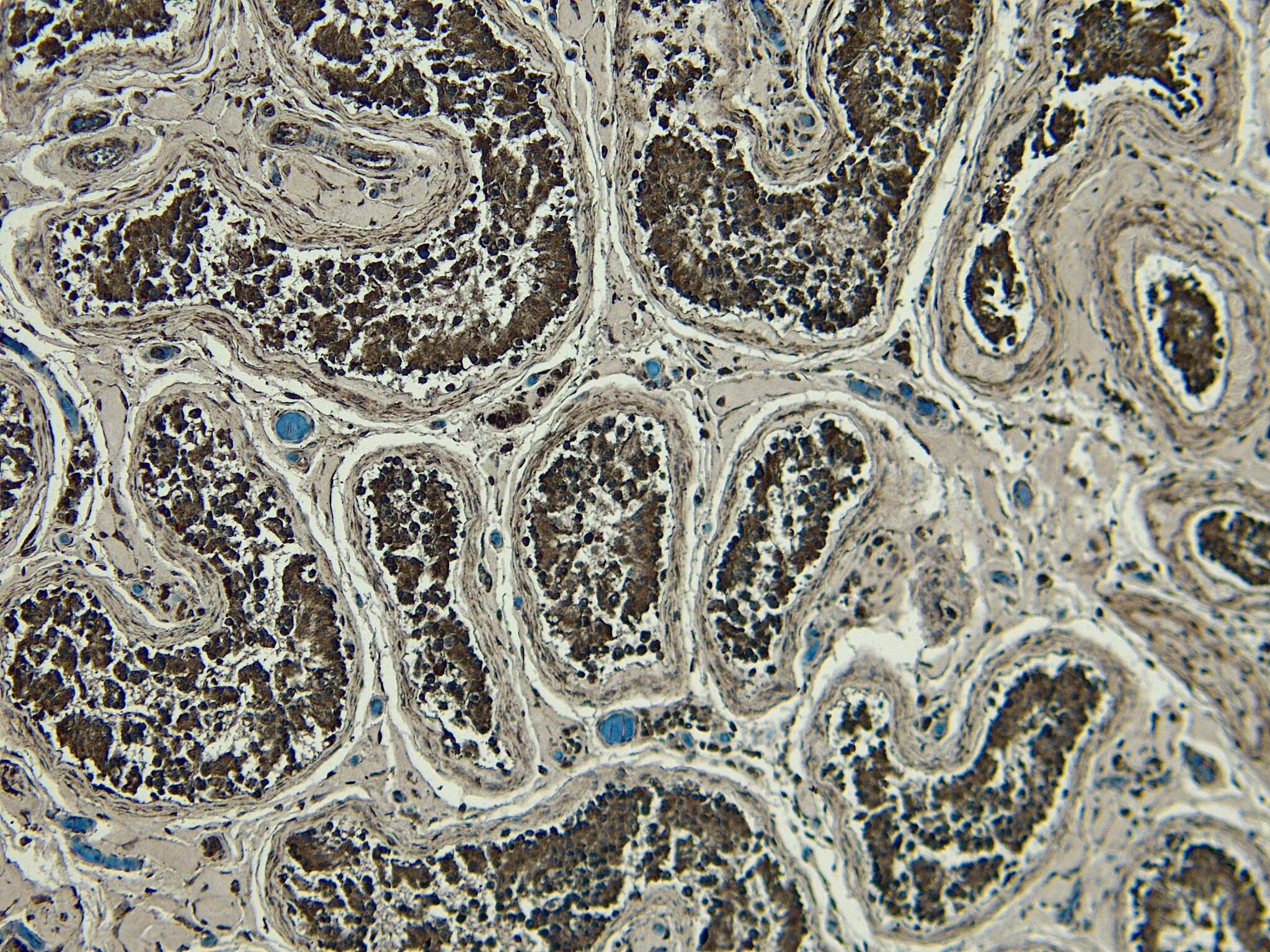 Immunohistochemistry-Paraffin: PLC-delta 3 Antibody [NBP3-20228]
