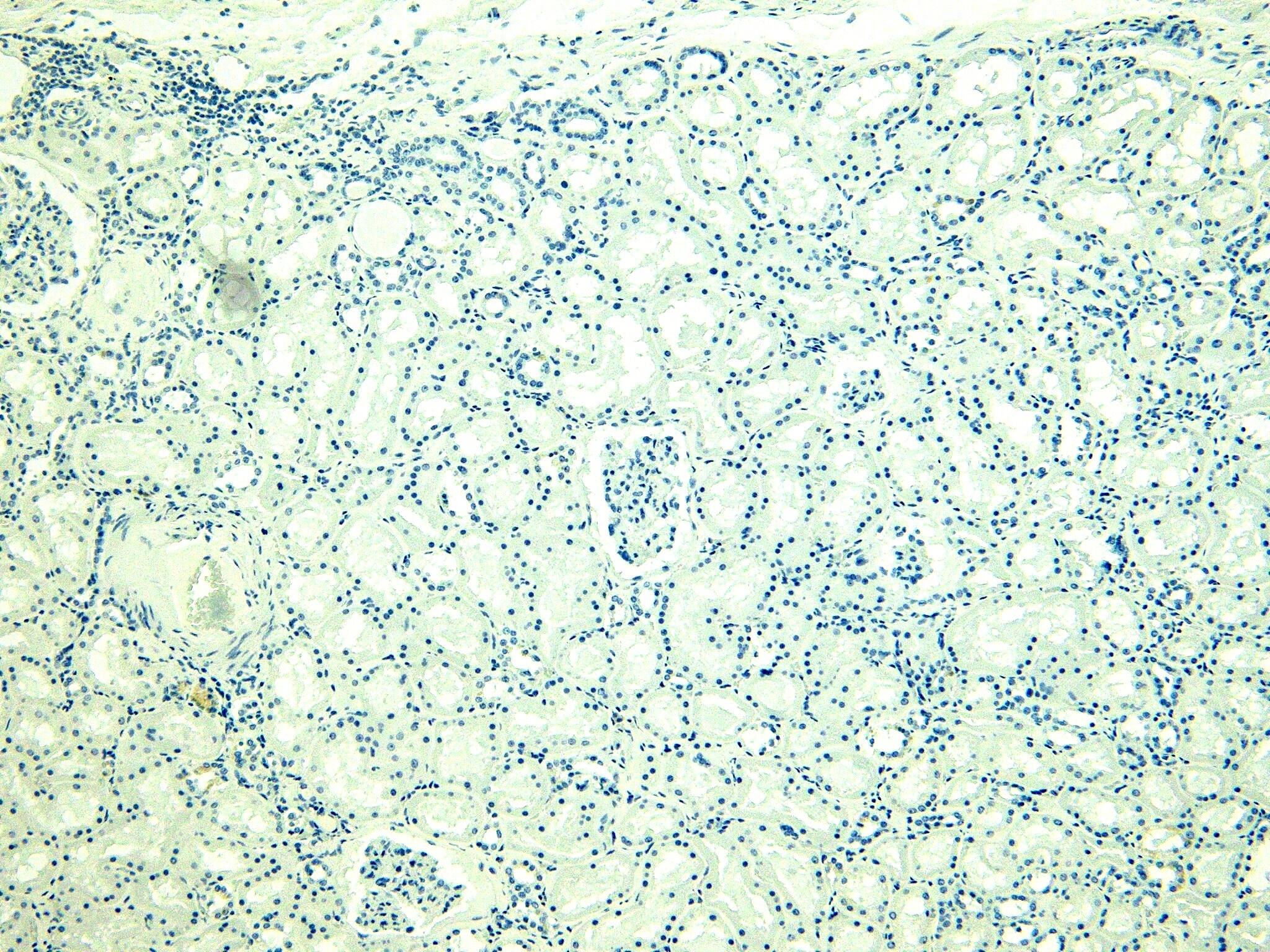 Immunohistochemistry-Paraffin: PLC-delta 3 Antibody [NBP3-20228]
