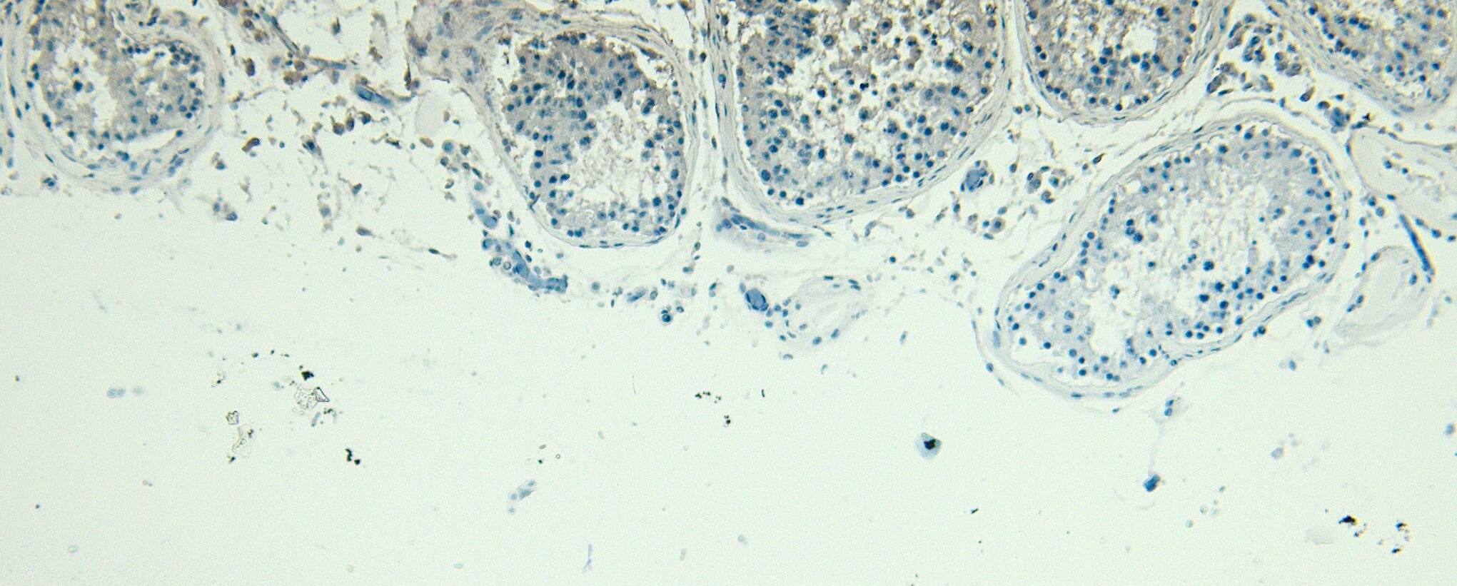 Immunohistochemistry-Paraffin: PLC-delta 3 Antibody [NBP3-20228]