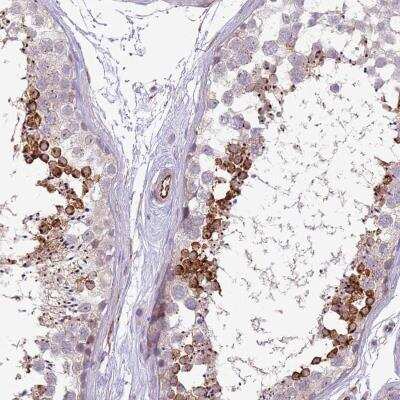 Immunohistochemistry: NBPF3 Antibody [NBP2-46734]