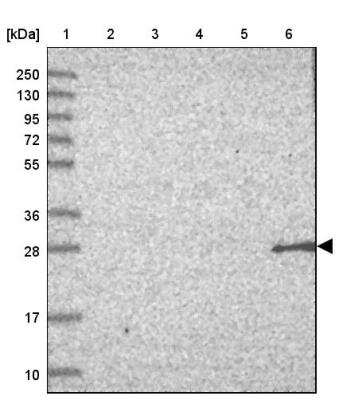 Western Blot: NBPF3 Antibody [NBP2-46734]