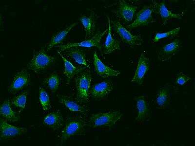 Immunocytochemistry/ Immunofluorescence: NBPF15 Antibody [NBP3-06172]