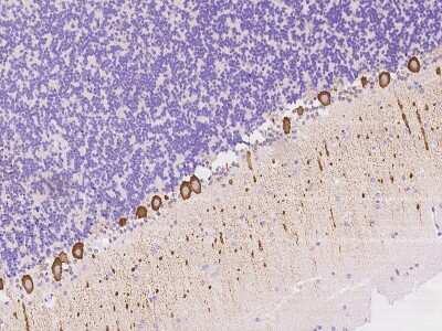 Immunohistochemistry-Paraffin: NBPF15 Antibody [NBP3-06172]