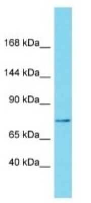 Western Blot: NBPF15 Antibody [NBP3-09717]