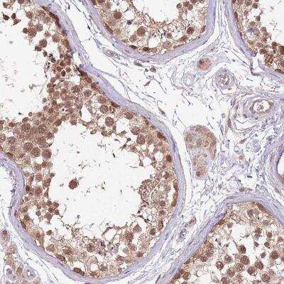 Immunohistochemistry: NBPF4 Antibody [NBP2-46710]