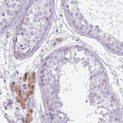 Immunohistochemistry: NBPF6 Antibody [NBP2-46749]