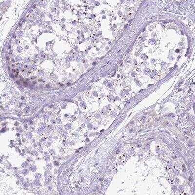 Immunohistochemistry-Paraffin: NBPF4 Antibody [NBP2-46724]