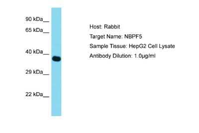 Western Blot: NBPF6 Antibody [NBP2-83258]