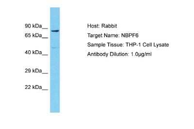 Western Blot: NBPF6 Antibody [NBP2-83259]