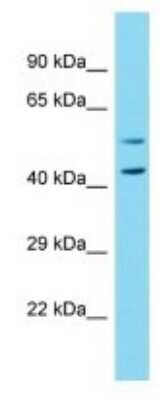 Western Blot: NBPF7 Antibody [NBP3-09752]