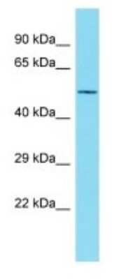 Western Blot: NBPF7 Antibody [NBP3-09753]